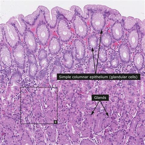 34 best Histology - Stomach images on Pinterest