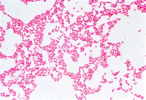 Image: Gram Stain (Escherichia coli) - MSD Manual Professional Edition