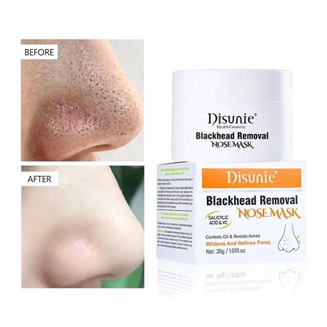 Remove Blackheads And Whiteheads Nose Mask Salicylic Acid Vs Blackheads Removel Nose Paches ...