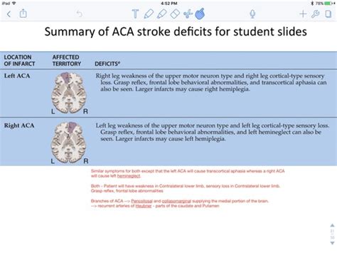 Stroke Syndromes Flashcards Quizlet