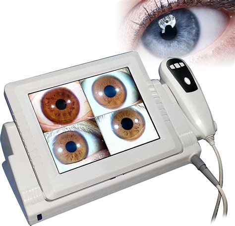 Iris Analysis Camera 2 Mega Pixels Iris Eye Analyzer With 8 Inch LCD