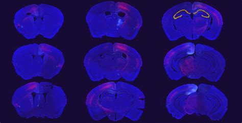 Whole Slide Imaging And Analysis Mbf Bioscience