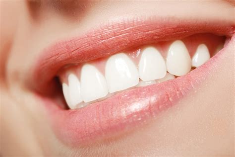 6 Important Health Benefits Of Having Straight Teeth