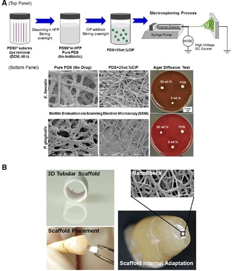 Summarized Schematic Of Nanofibrous Antibiotic Containing Scaffolds