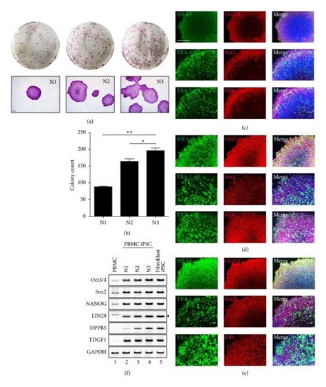 Stemness Characterization Of Ipscs Generated By The Established