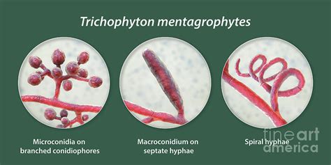 Fungi Trichophyton Mentagrophytes Photograph By Kateryna Kon Science