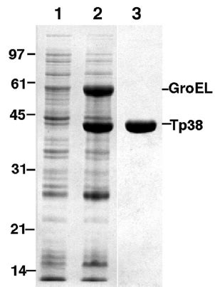 Expression Of Tp In E Coli And Puri Fi Cation Of Recombi Nant