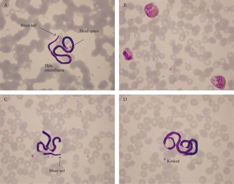 Microscopical Diagnosis Of Blood Parasites Haema