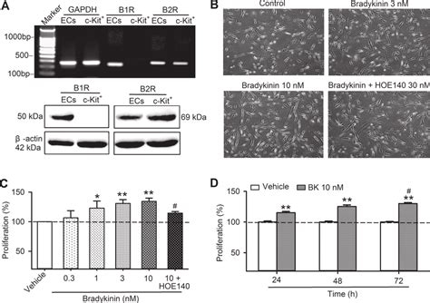 The expression of bradykinin receptors and bradykinin effect on cell ...