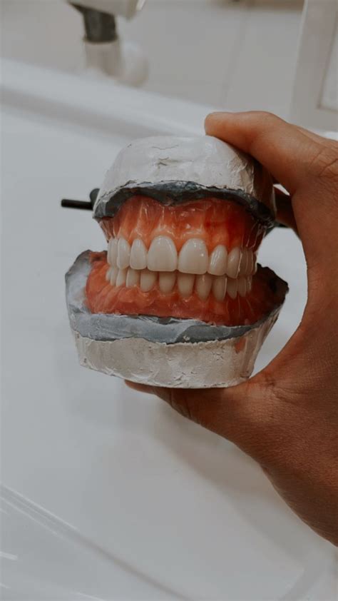 Denture En Laboratorio Dental Trabajo Dentista Odontolog A