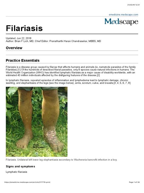 Filariasis: Signs and Symptoms | PDF | Clinical Medicine | Immunology