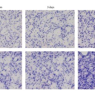 Evaluation Of The Biocompatibility Of An Injectable Hydrogel