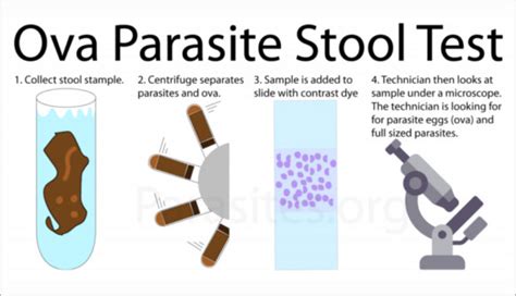 Ova And Parasite Test Health News Reviews And Tips