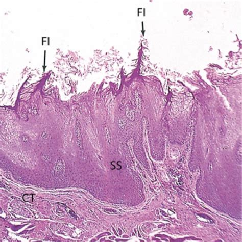 Systems Oral Cavity Salivary Glands Flashcards Quizlet