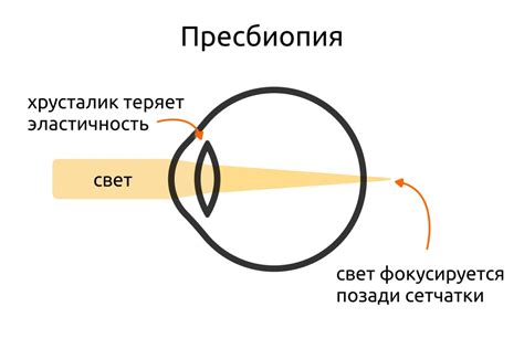 Пресбиопия - что это, причины, симптомы, диагностика, лечение