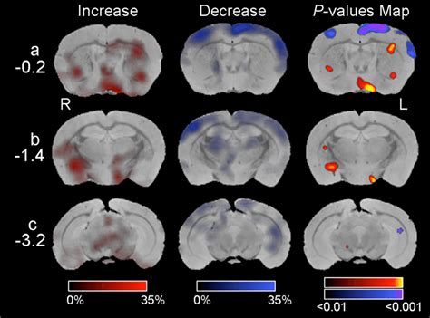 Changes Of Regional Cerebral Blood Flow Rcbf In Nptn Loxloxemx Cre