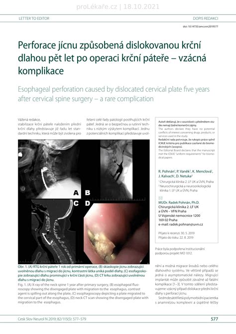 PDF Esophageal Perforation Caused By Dislocated Cervical Plate Five