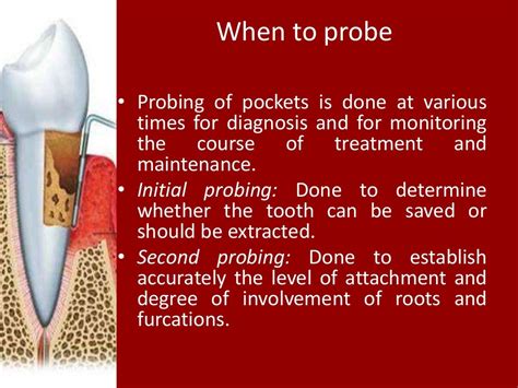 Periodontal Pockets