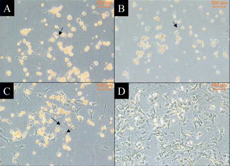 Phase contrast images of rat hepatic stellate cells in culture. (A) 24... | Download Scientific ...