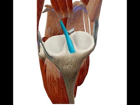 Orthopedics 167 Anterior Crutiate Ligament Where Find Location Search