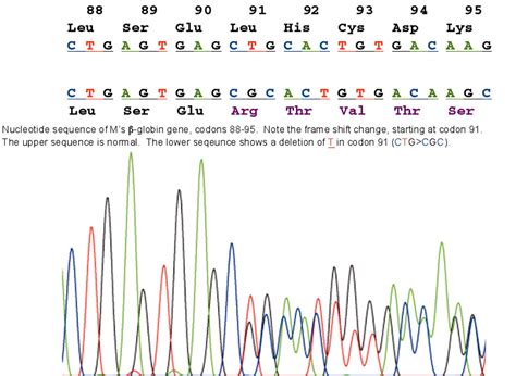 Dominantly Inherited β Thalassaemia Intermedia Caused By A New Single