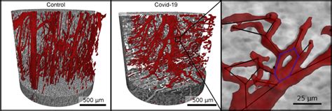 Heart Tissue Image Eurekalert Science News Releases