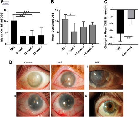 Donated Human Eye Tissue Offers Hope Of Restored Vision