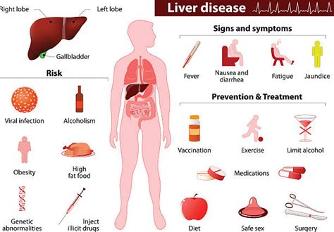 Liver Metabolism Illustrations, Royalty-Free Vector Graphics & Clip Art ...