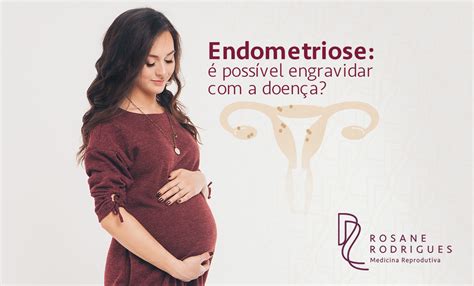 Endometriose Poss Vel Engravidar A Doen A Dra Rosane