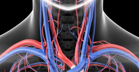 Superior Vena Cava Syndrome Mind The Bleep