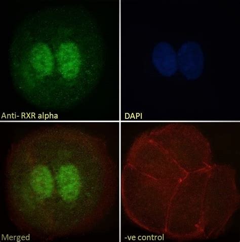 Retinoid X Receptor Alpha Rxra抗体 Ab24363 Abcam中文官网