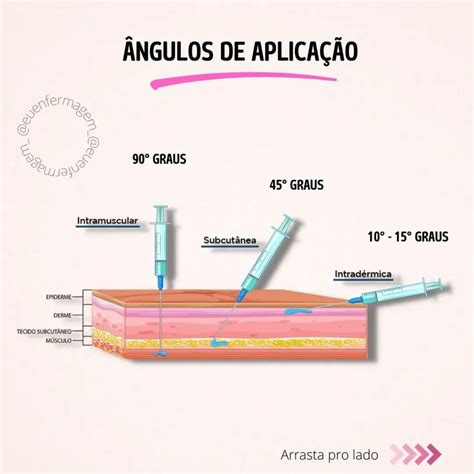 Ngulos De Aplica O Curso De Enfermagem Ngulos Aplica Es