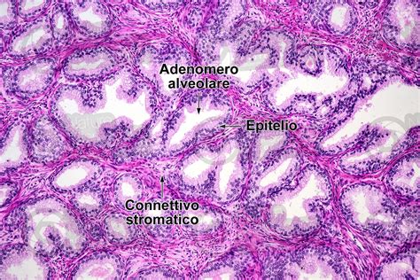 Uomo Prostata Sezione Trasversale X Uomo Mammiferi Apparato