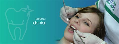 Est Tica Dental