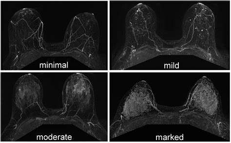 Cancers Free Full Text Current Landscape Of Breast Cancer Imaging