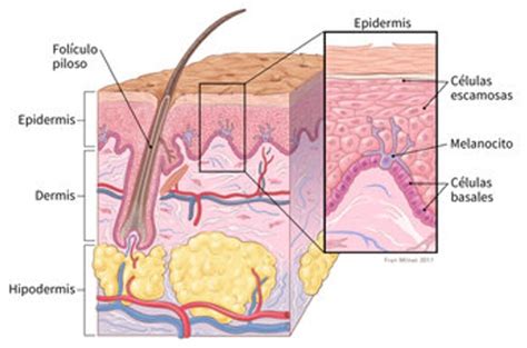 Carcinoma De Células Basales Diagnóstico Y Abordaje Cio Salud