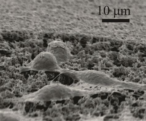 Electron Microscopy Showing The Fibroblast Cell Attachment To