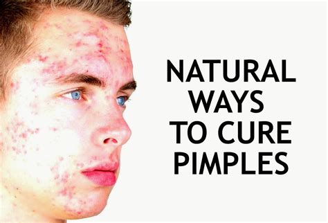 How To Cure Pimple Naturally ~ Inspire Me