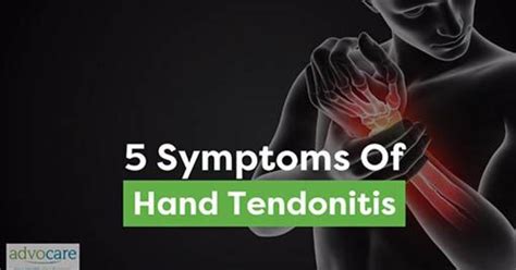 Spotlight Video 5 Symptoms Of Hand Tendonitis Glen Wainen MD