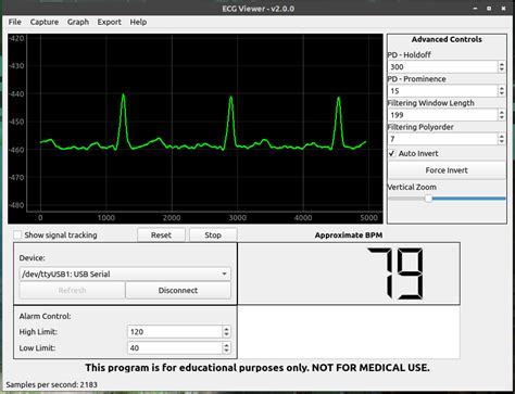 GitHub HTM Workshop ECG Viewer ECG Viewer Is A Graphical Interpreter