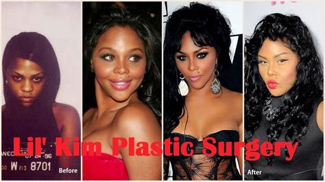 Plastic Surgery: Questions on Lil Kim Plastic Surgery