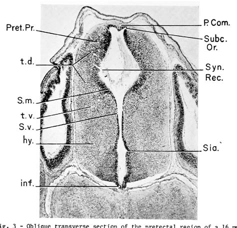 Figure 3 From The Development Of The Pretectal Nuclei In Trichosurus Vulpecula Semantic Scholar