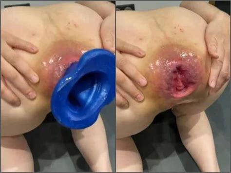 Anal Prolapse Videos Colossal Dildo Booty Camgirl M687pro Colossal Butt Plug Fully Fucking