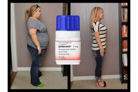 Rybelsus Weight Loss Breakthrough In New York Usa Spring 2024 New