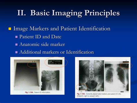 PPT Introduction Of Radiographic Technology PowerPoint Presentation