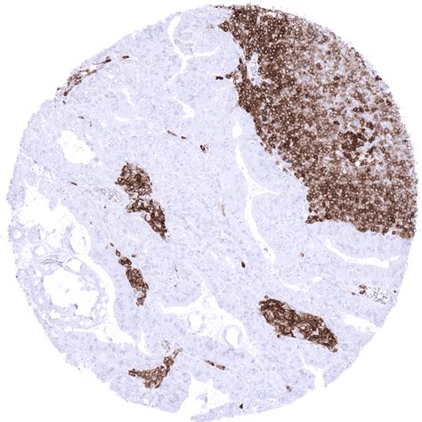 Cancer Tissue Gallery CD27 - MS Validated Antibodies