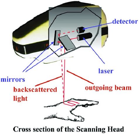 The Pim Ii Laser Doppler Perfusion Imager System For Non Invasive