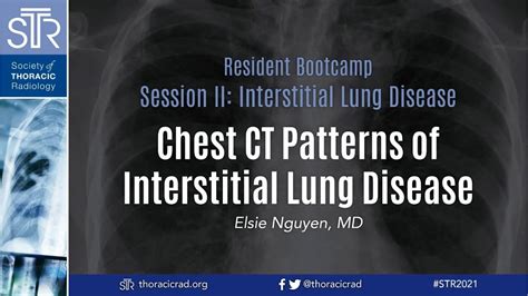 Chest CT Patterns Of Interstitial Lung Disease YouTube