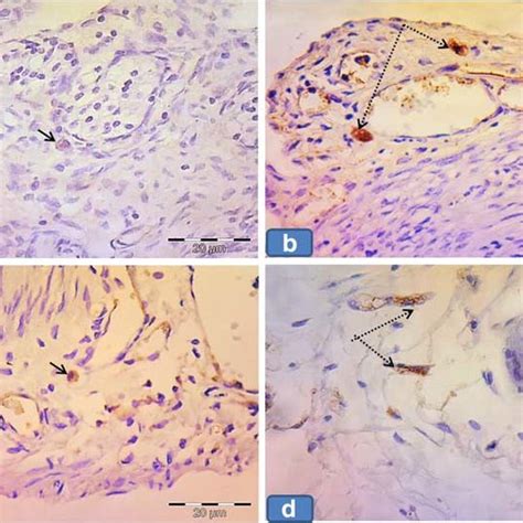 Photomicrographs Of Sections In The Ovarian Tissue COX 2 Immunostained