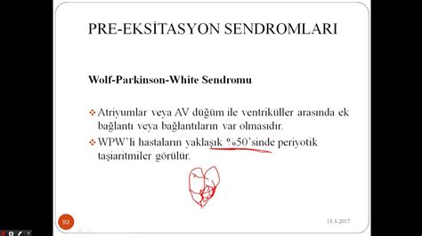 Wolff Parkinson White Sendromu Ilaç Tedavisi